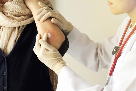 Monsoon Skin Problems in India Monsoon Skin Problems in India-Activ Together