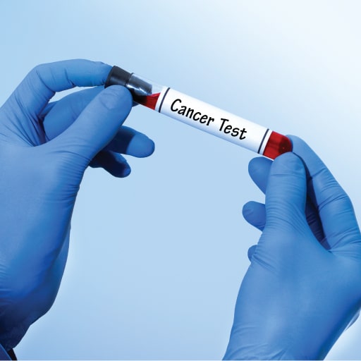 Cancer Test
