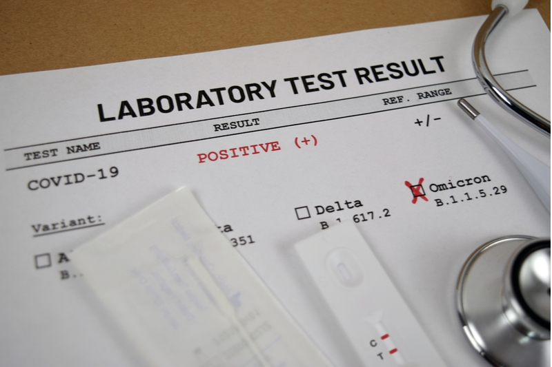 Covid-19 omicron test results_activ living