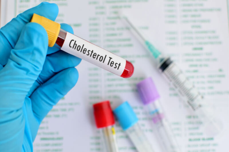 Cholesterol Test_Activ Living Community