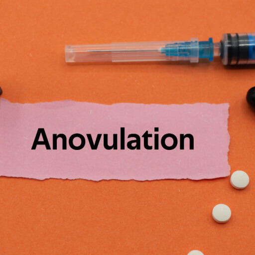 Anovulation_Activ Living Community