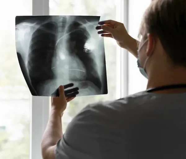 back-view-doctor-looking-radiography_Activ Living Community