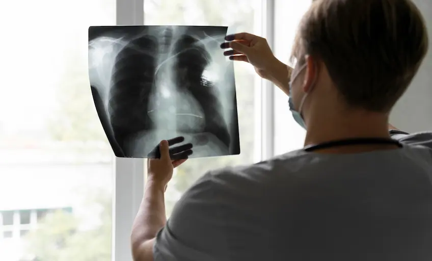 back-view-doctor-looking-radiography_Activ Living Community