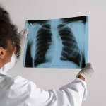 side-view-doctor-looking-radiography_Activ Living Community