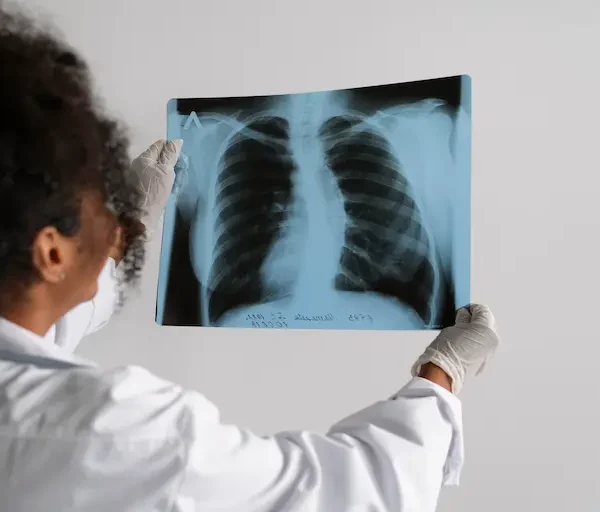 side-view-doctor-looking-radiography_Activ Living Community