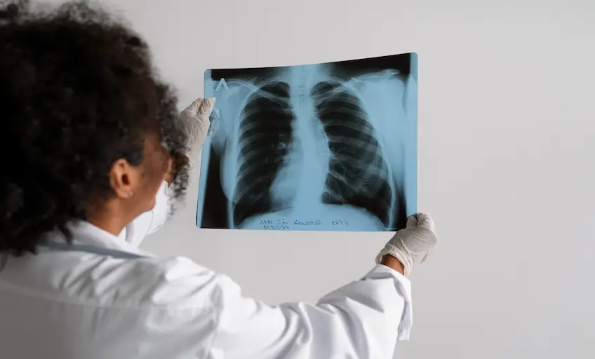 side-view-doctor-looking-radiography_Activ Living Community