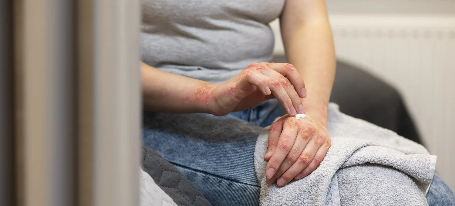 Diabetic Skin Conditions